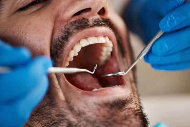 Best Emergency Treatment for Oral Infections in Little Flock, AR