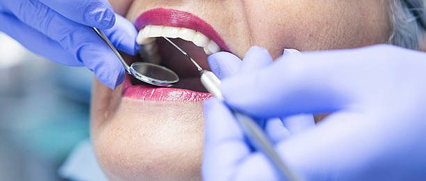 Best Dental Abscess Treatment in Little Flock, AR
